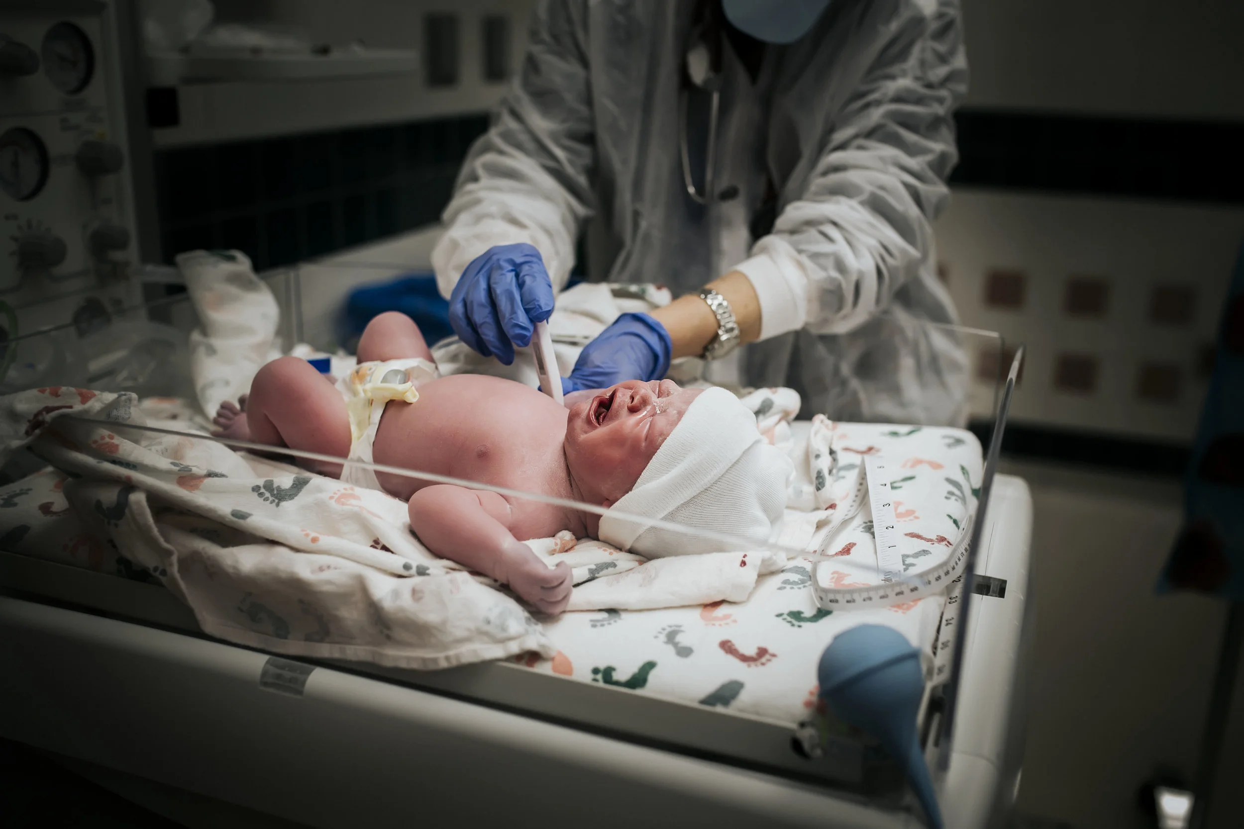 birth photography for c-section