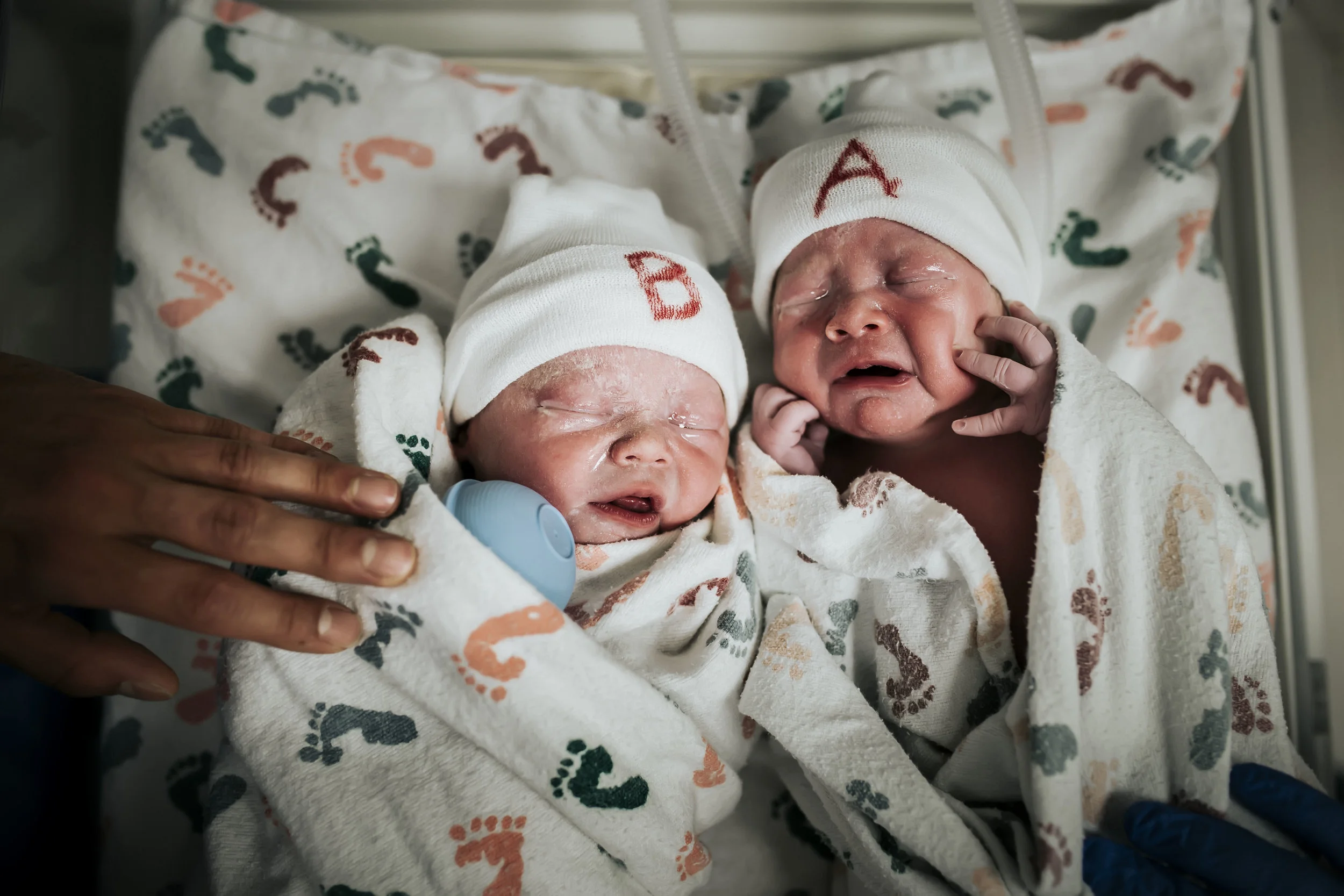 twin birth 