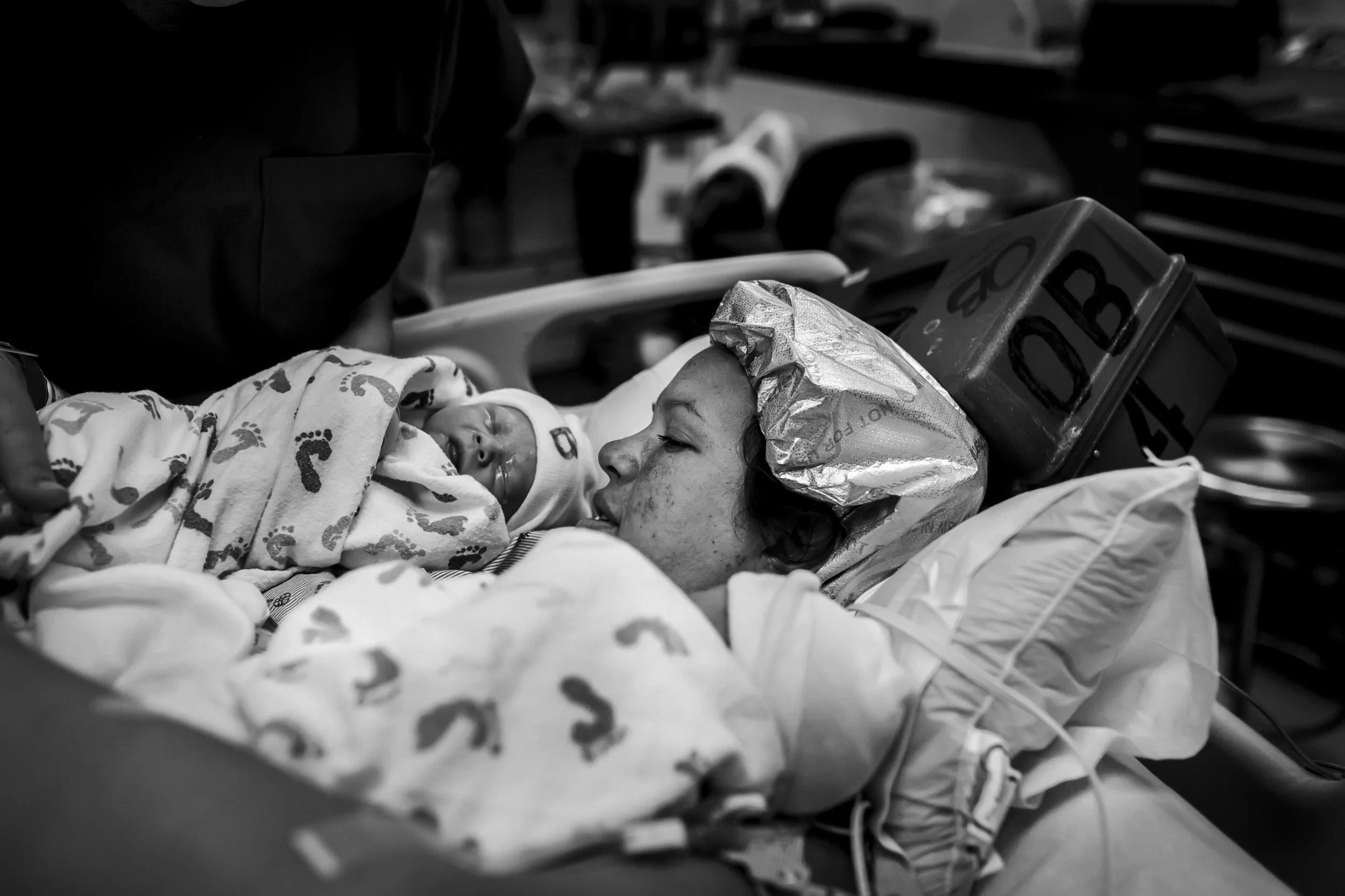 twin cesarean