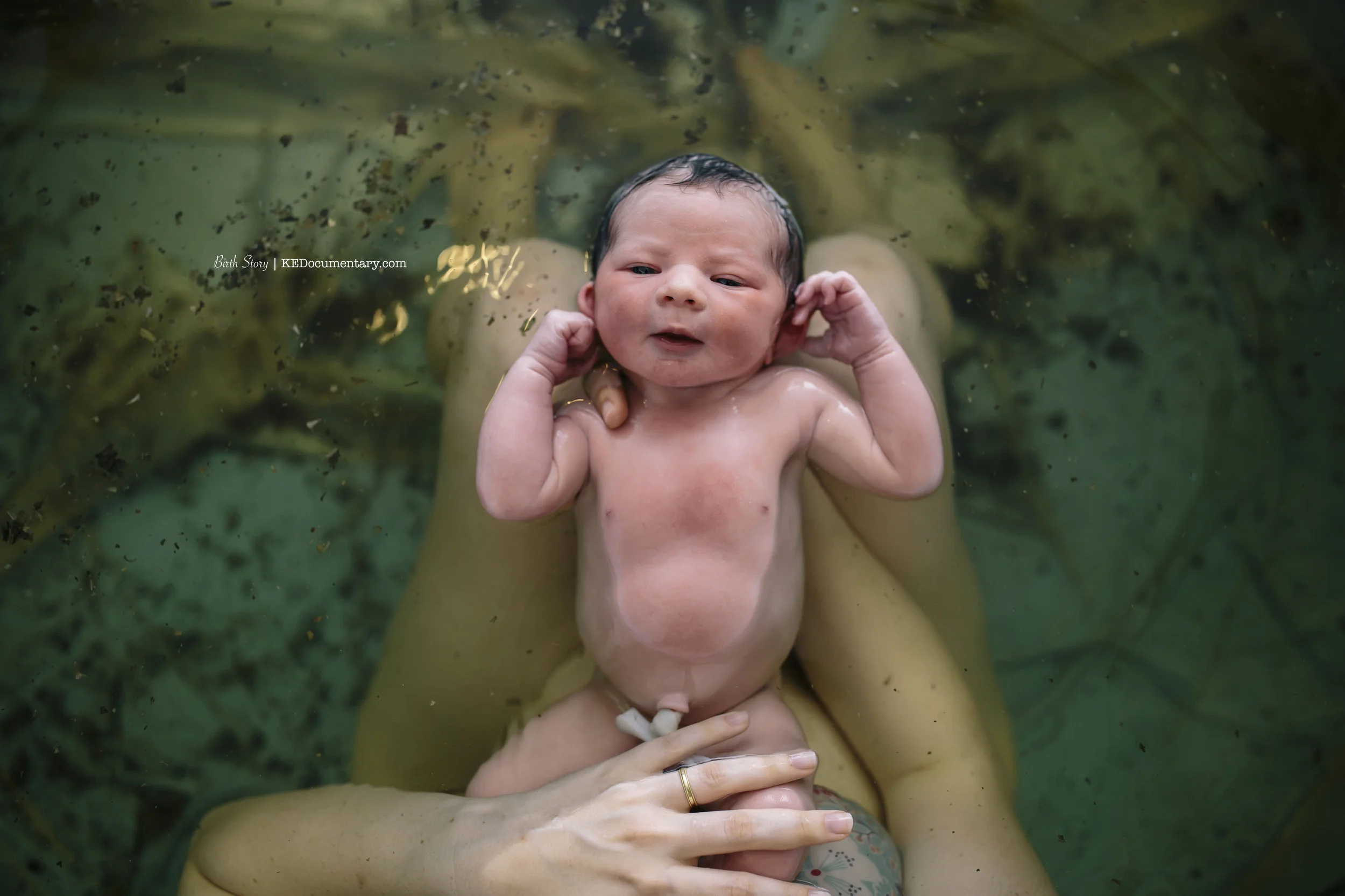 water birth in Dallas