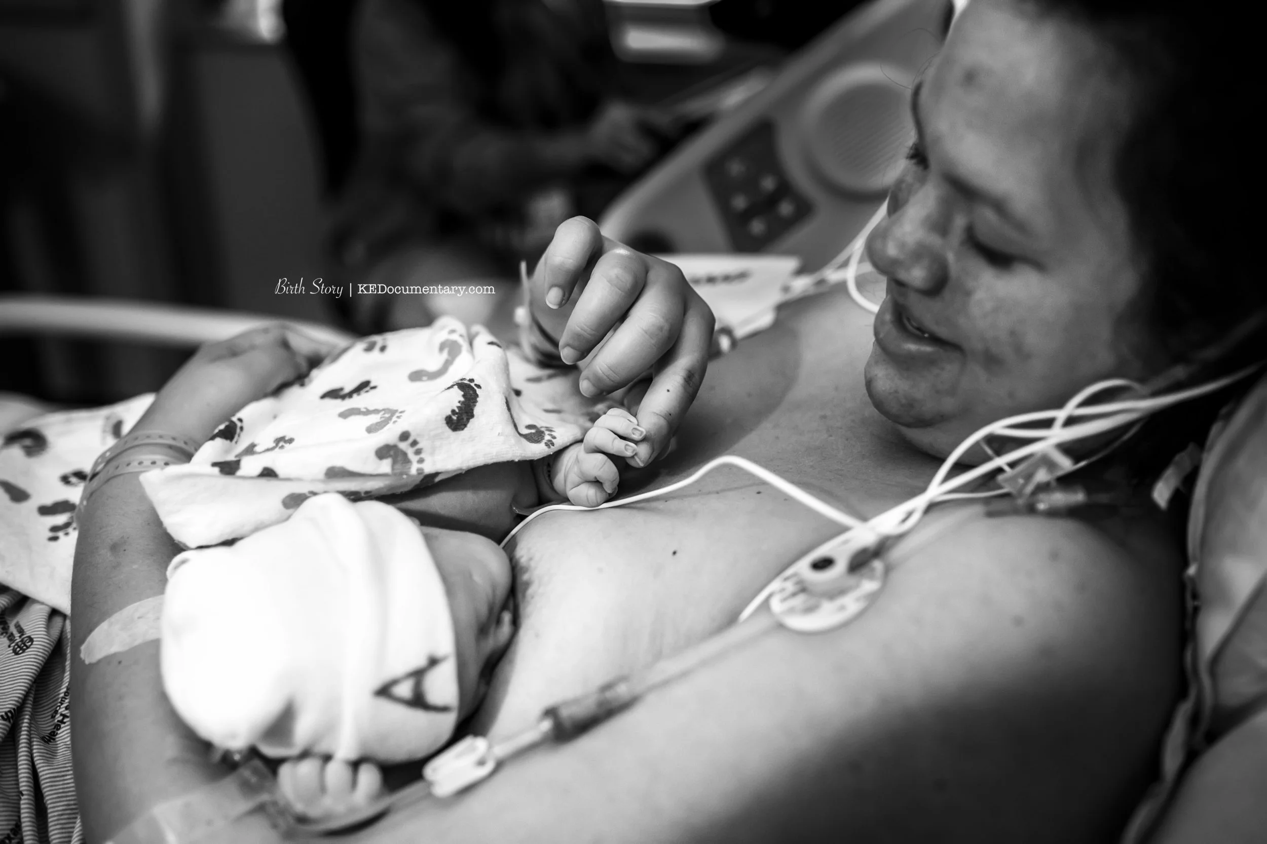  Dallas / Fort Worth Texas | Cesarean Birth Photography 