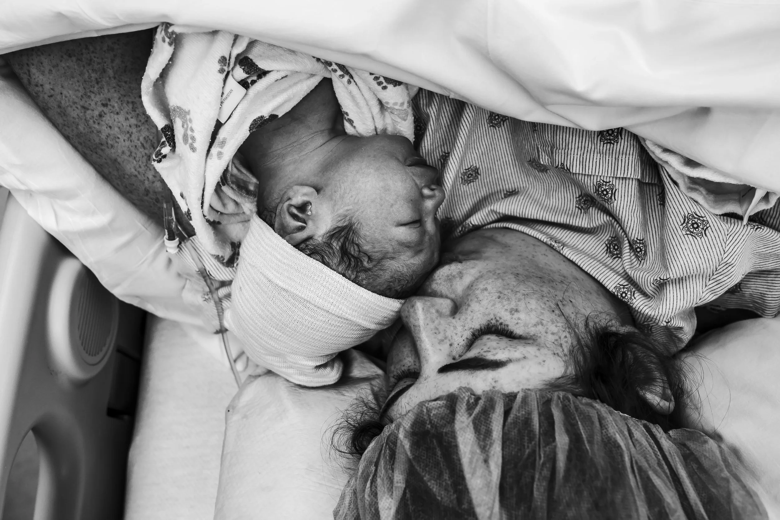 cesarean birth 