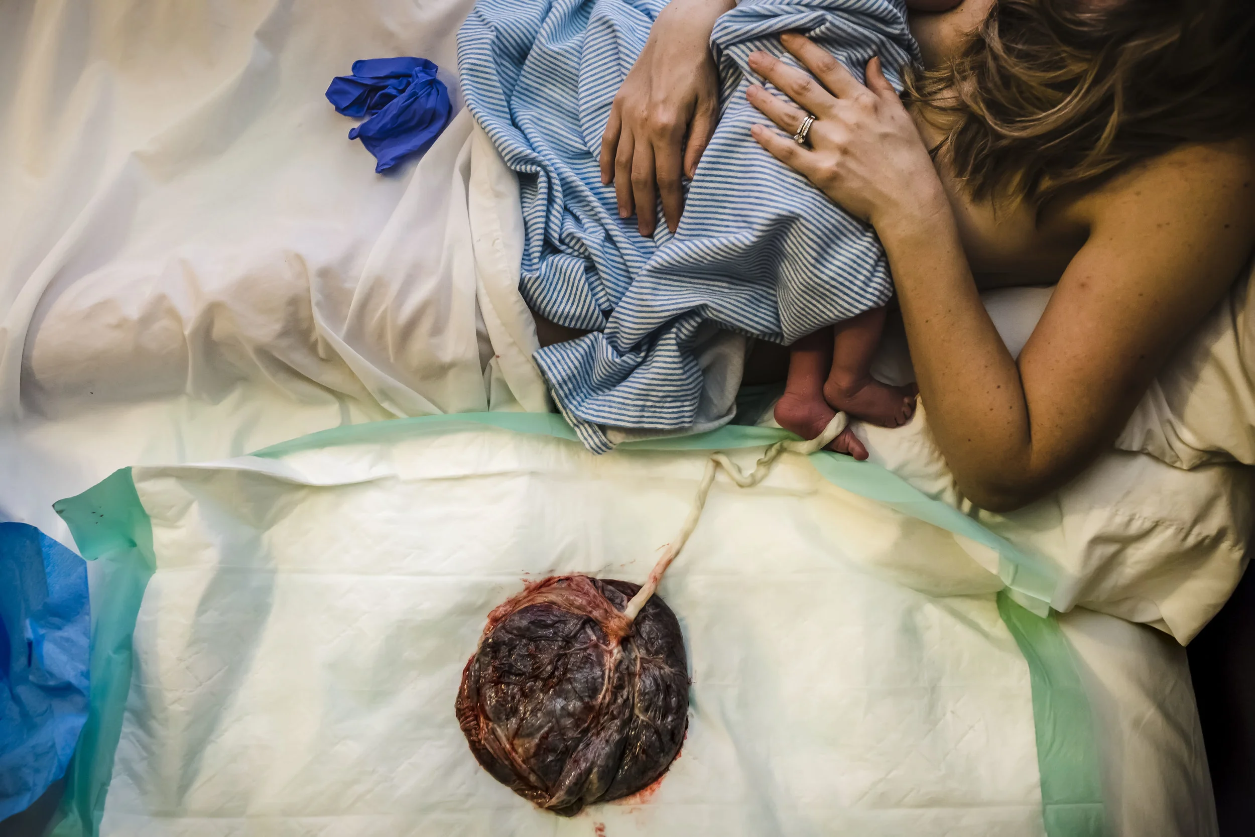 placenta 