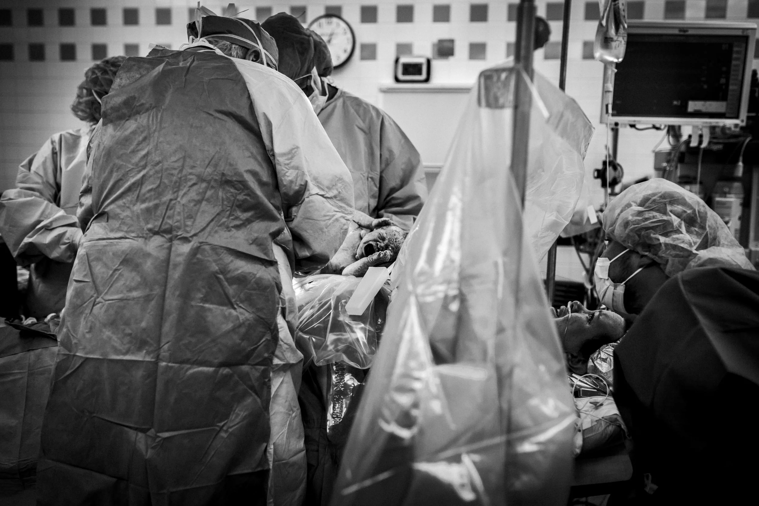 Texas Health Cesarean Birth Photographer