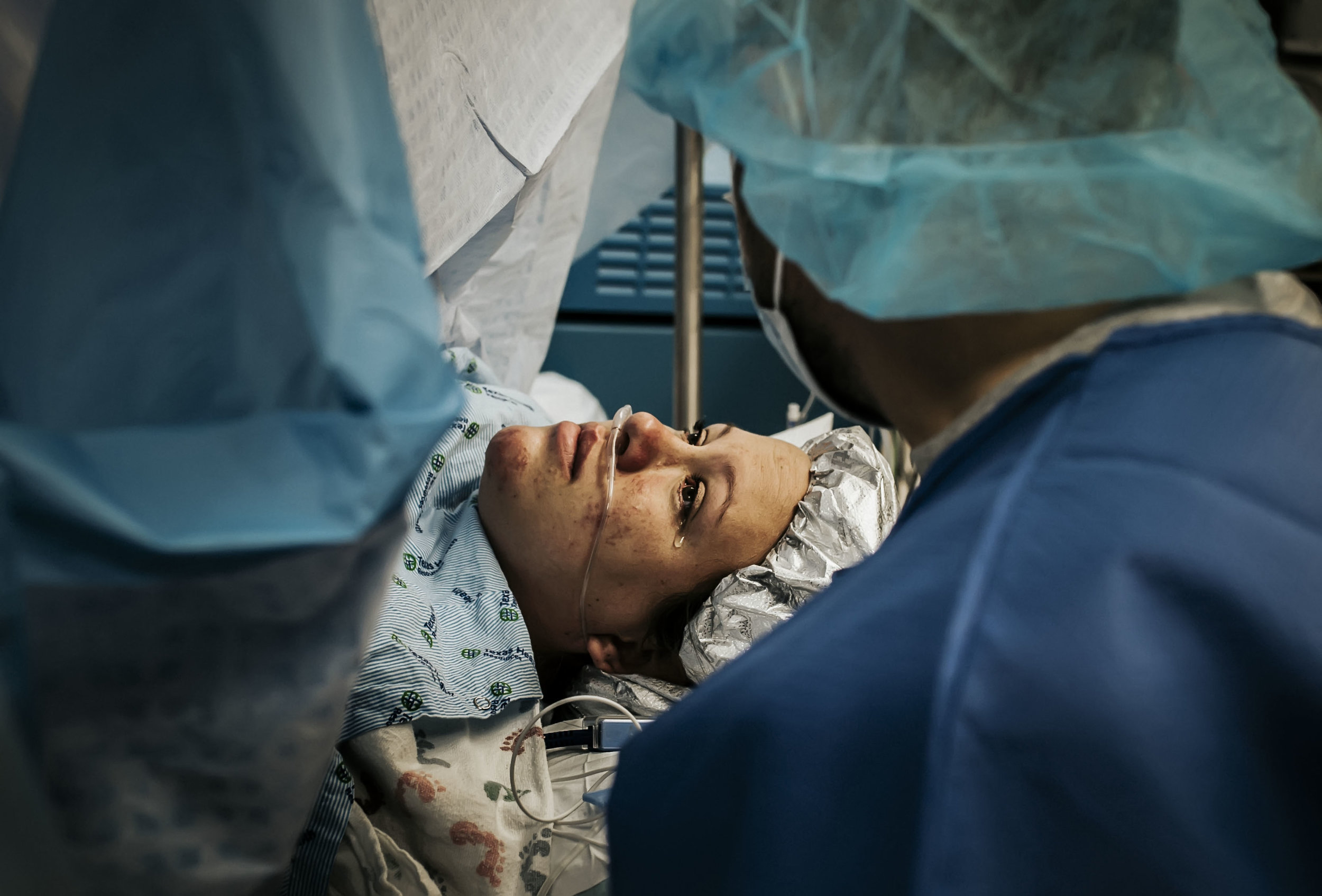 DFW cesarean birth