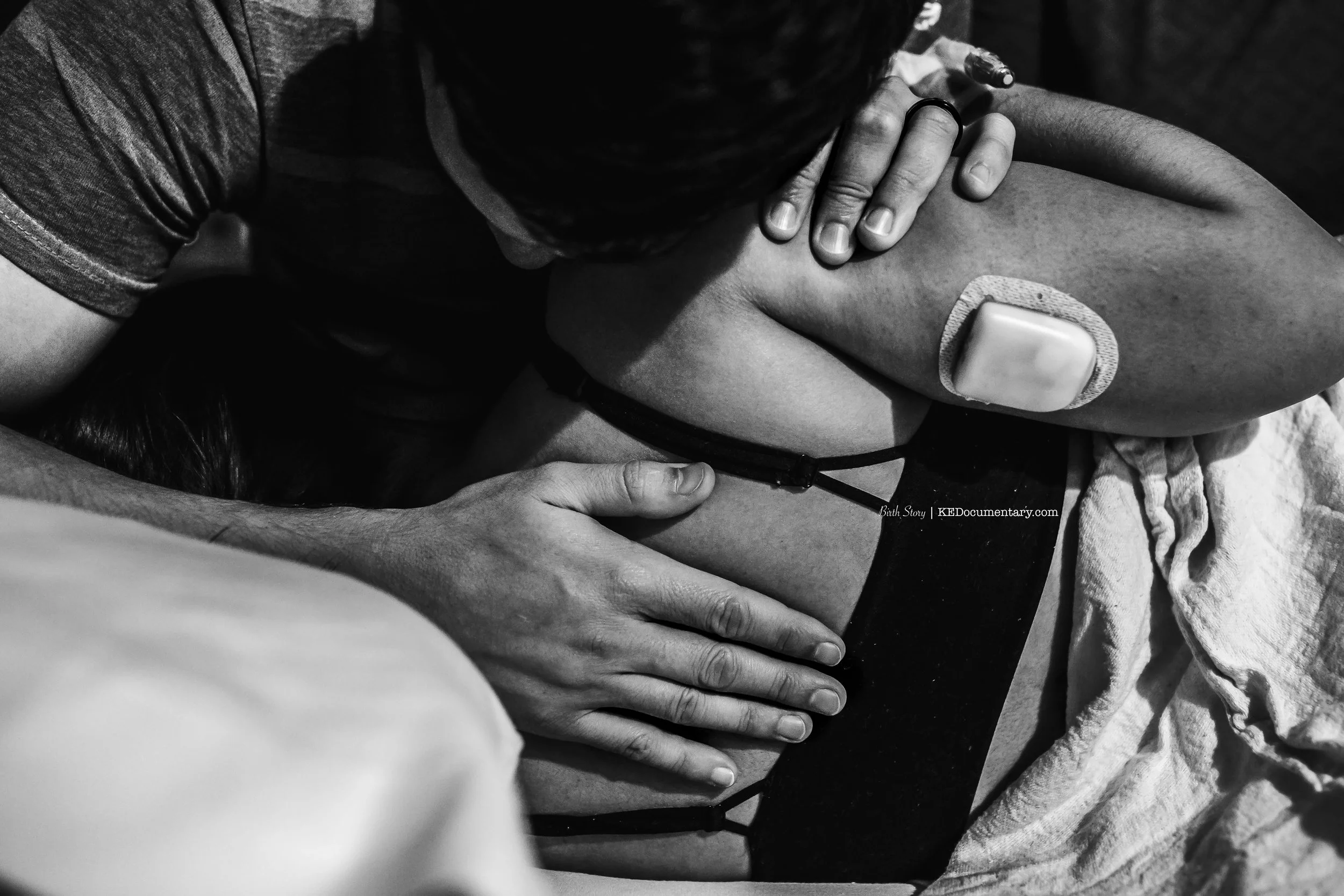 VBAC with Type One Omnipod 