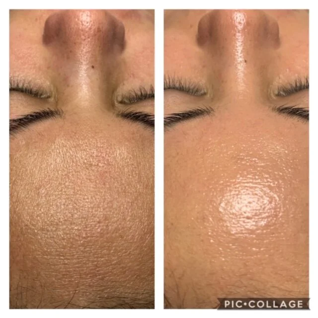  BEFORE ON LEFT, AFTER ON RIGHT 