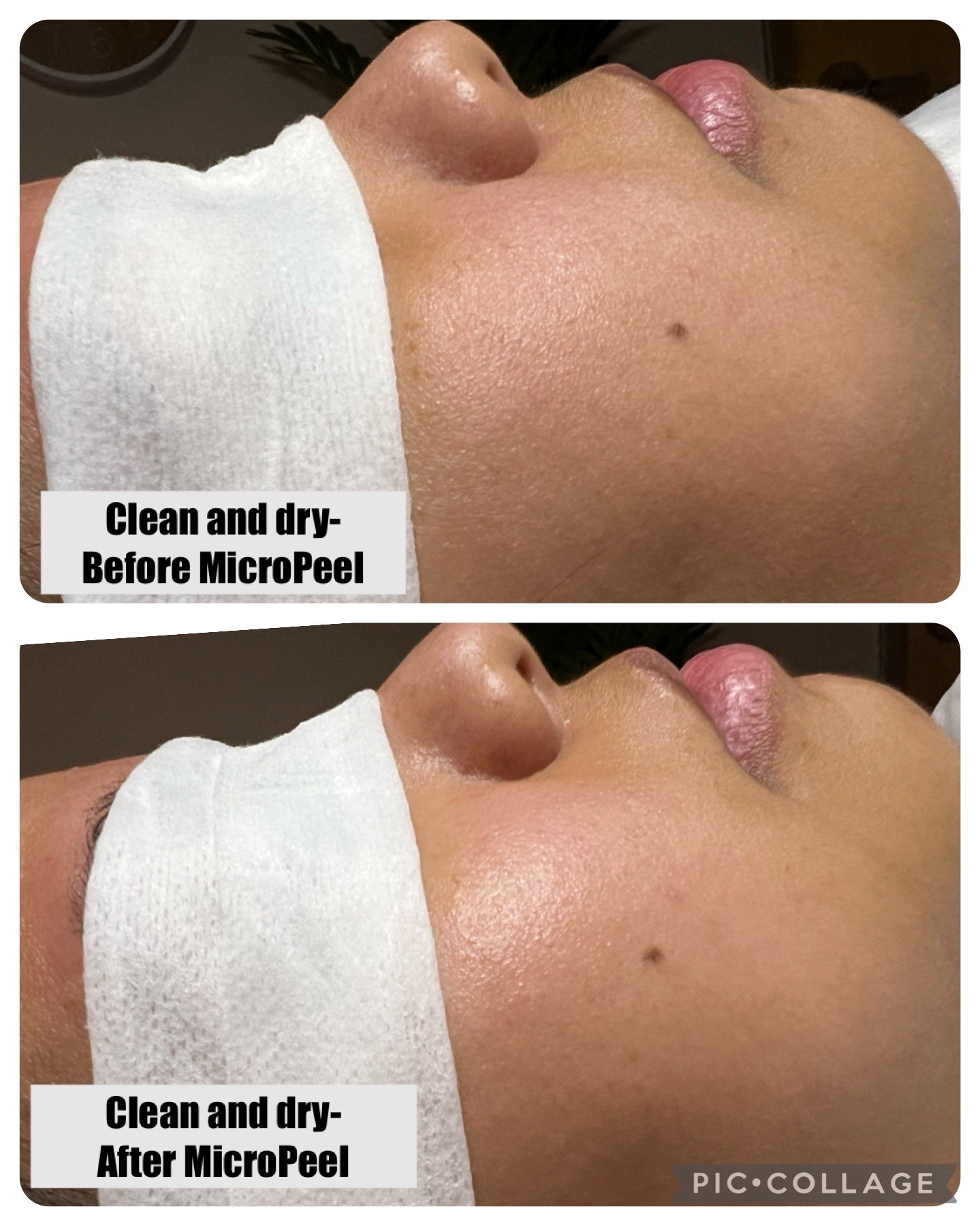 micropeel.JPG
