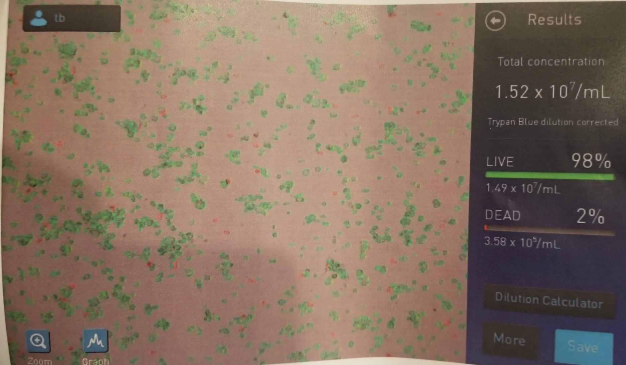 Stem cell therapy progress 1