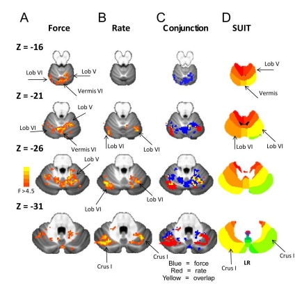fmri2.jpeg