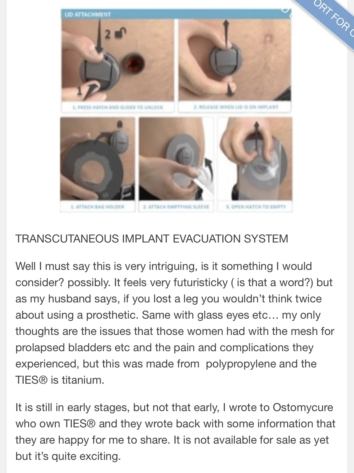 Info from tomasthestoma.couk and Ostomycure Also if anyone is interested in other Stoma supportive sites, OstomyConnection posted a great article the other day, even if I do say so my self! Hahahahaha Follow OstomyConnection on Twitter, Facebook and Insta.