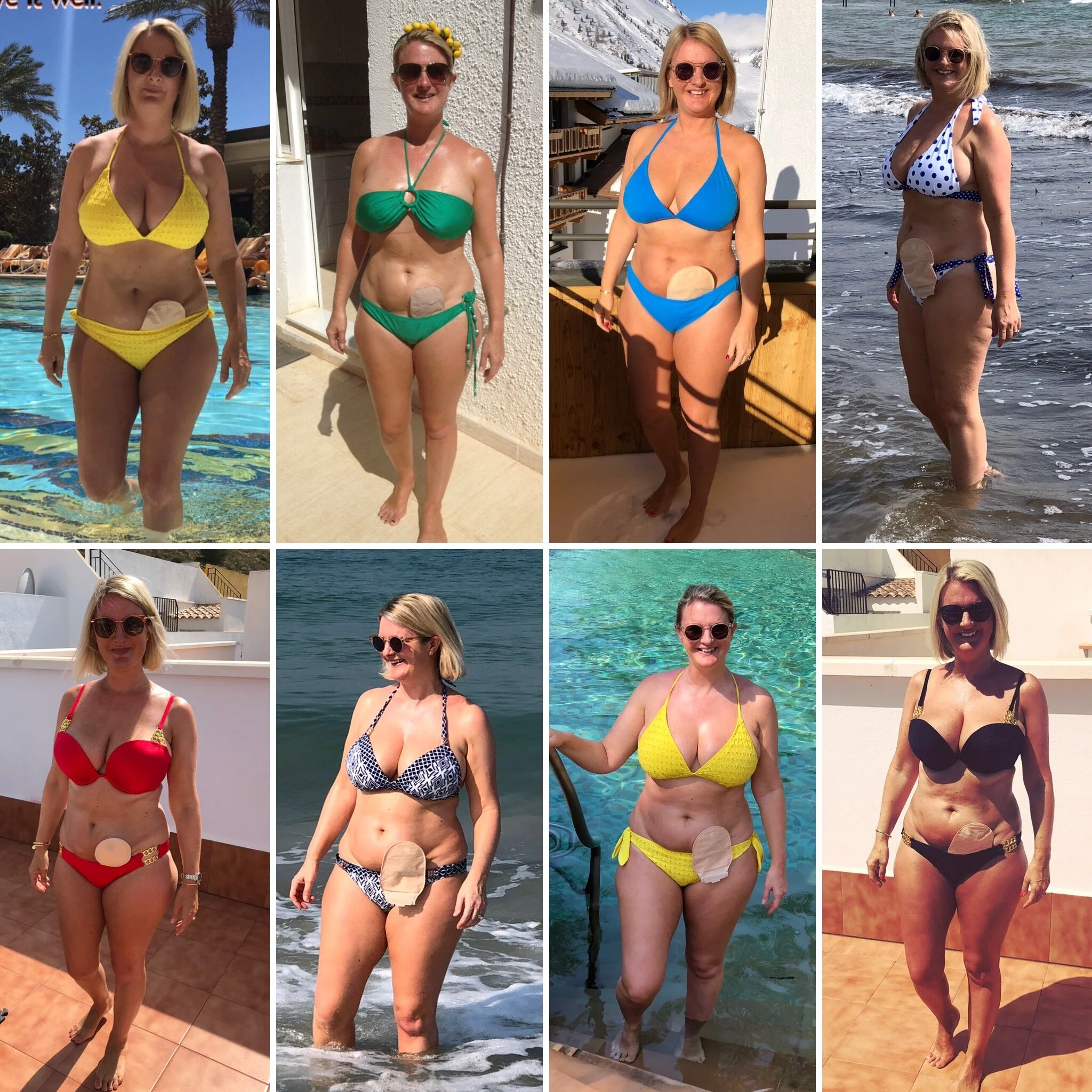 Every day is World Ostomy Day…