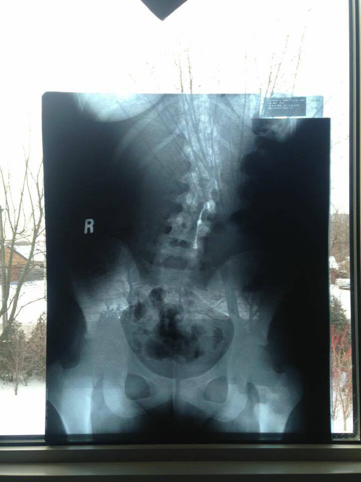 I've been told the black clouds are farts. Also, I did not know boobs would appear on an x-ray...