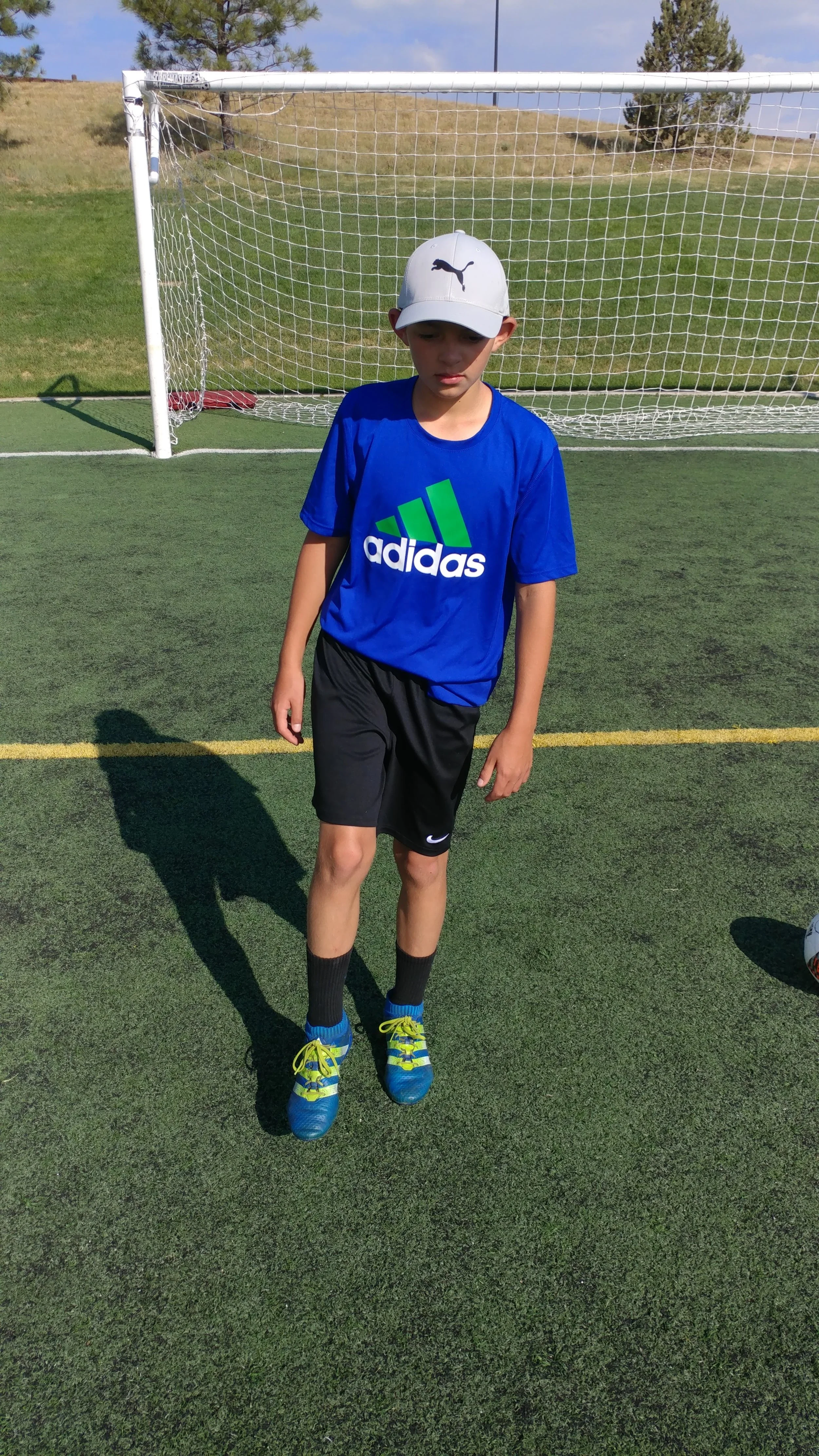 Hip Hikes 10 reps x3/day on both sides.*****Changes/Updates******* Increase reps to 15-20********Update********8/2/17****** Can add 1-2 lb ankle weight for progression. If done, reduce reps down to 10. Then progress back up to 20 reps.