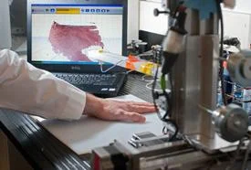 This scanner lets a bioprinter know exactly where to apply skin cells. It could save the lives of thousands of burn victims each year.