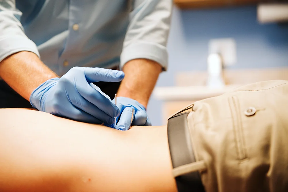 Integral-Physical-Therapy-Dry-Needling.jpg