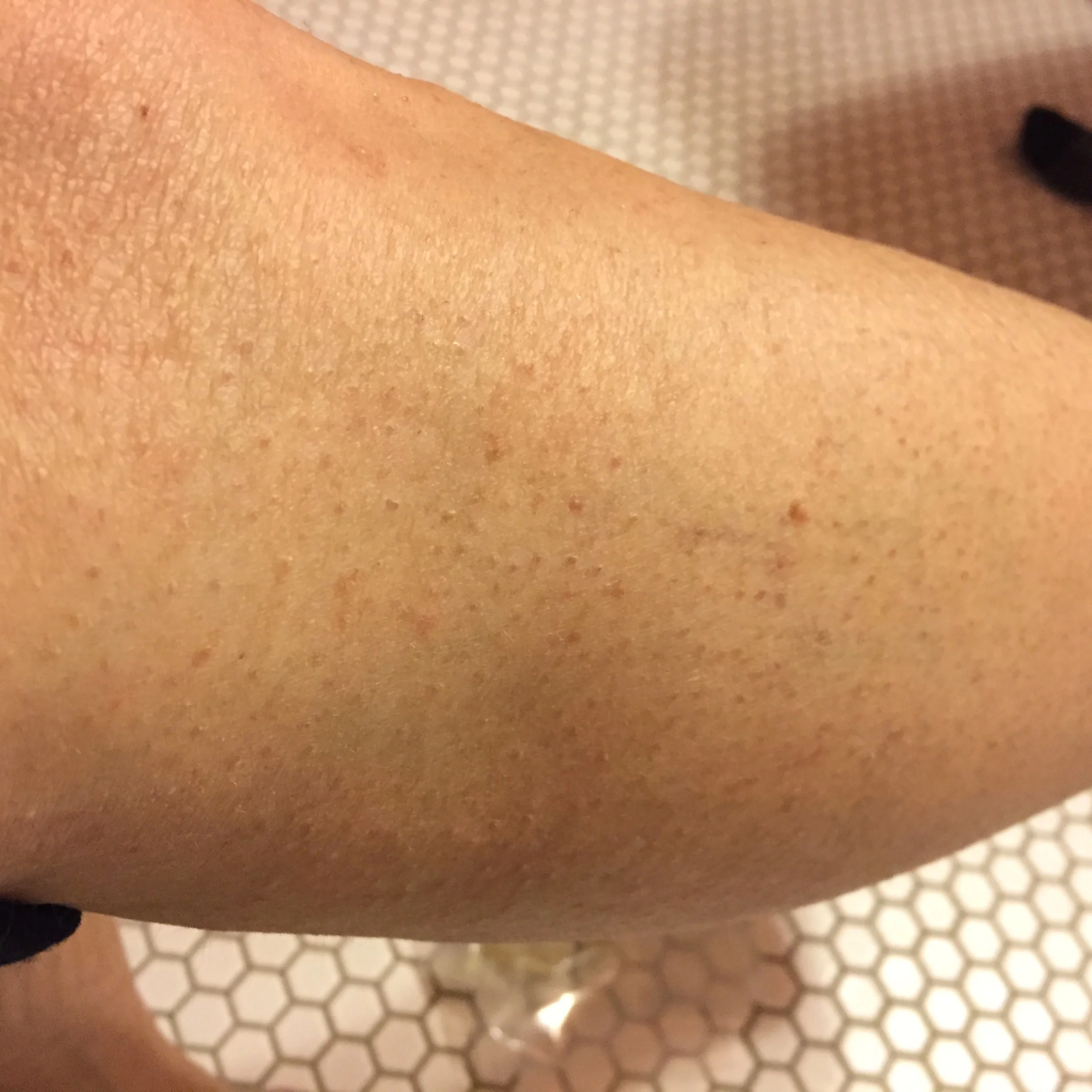 My old, dry leg before using any product.