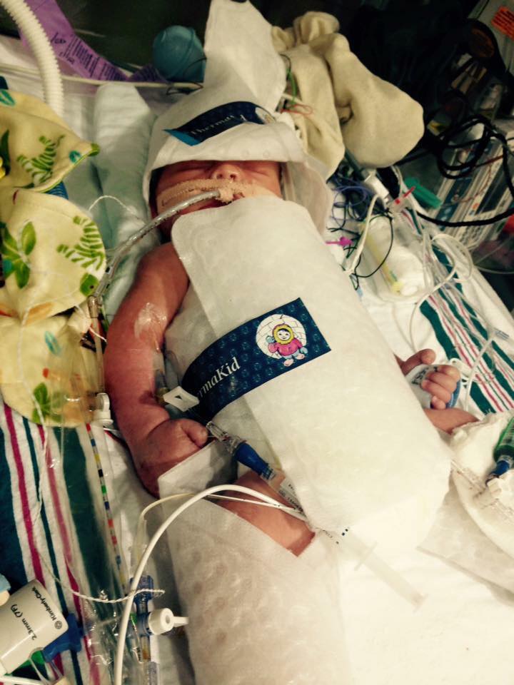 Jude on the night of his birth after being transported to Winnie Palmer Hospital for Women and Children, Orlando, FL