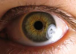 eye with possible glaucoma