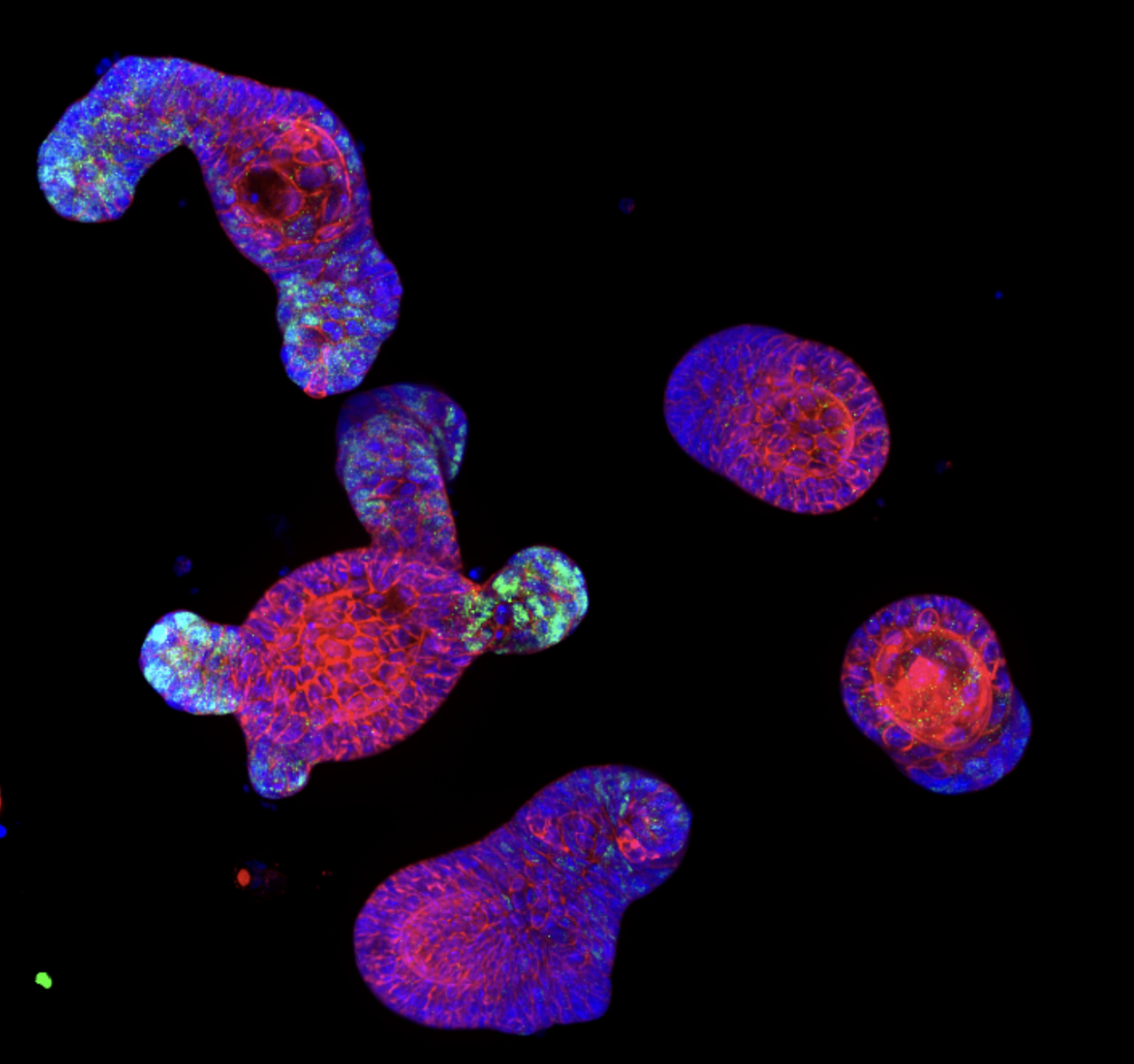 &nbsp;A 21st-Century Biology Bluff: The NIH’s Political Pause on Human Fetal Tissue Research
