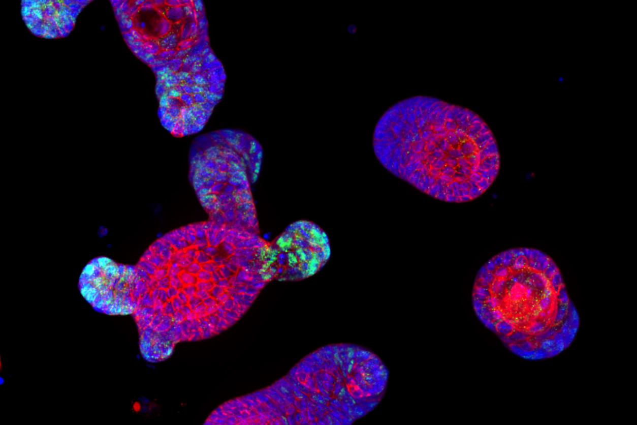 A 21st-Century Biology Bluff: The NIH’s Political Pause on Human Fetal Tissue Research