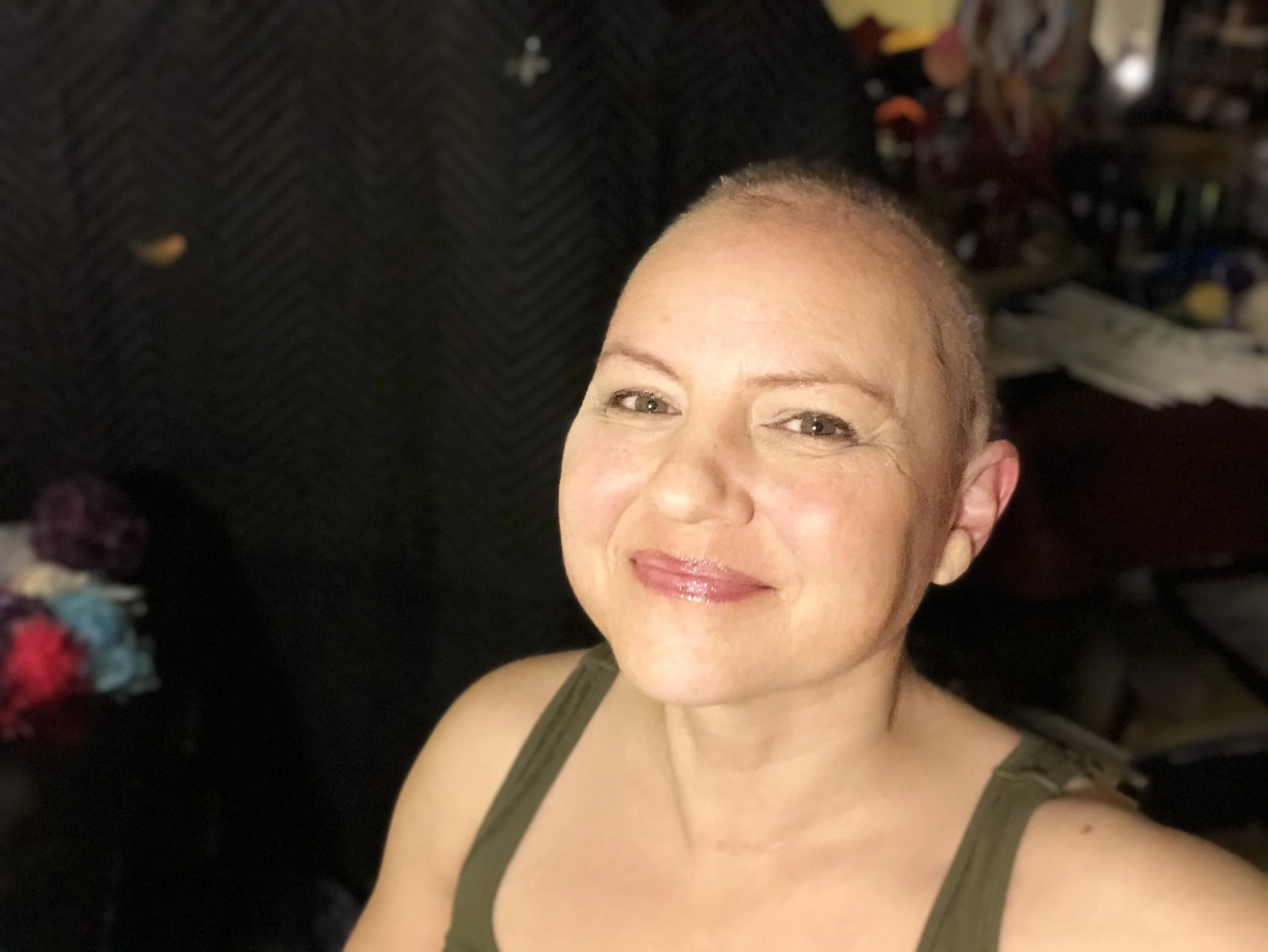 You're UGLY!?!? Part 2 of the Hair Loss Conversations