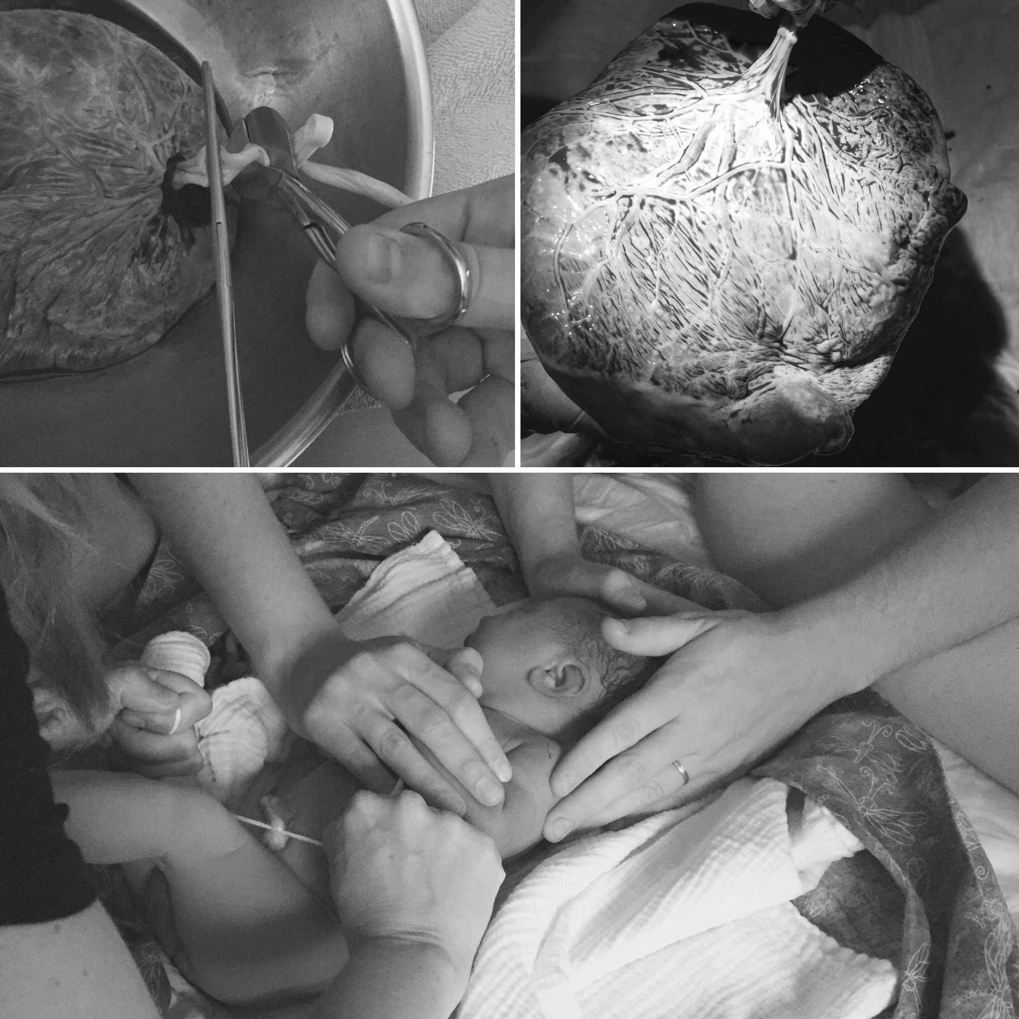 Taylor cutting the Umbilical Cord, my Placenta with it’s fascinating “tree of life” pattern of veins, & Cassian’s Cord Tie