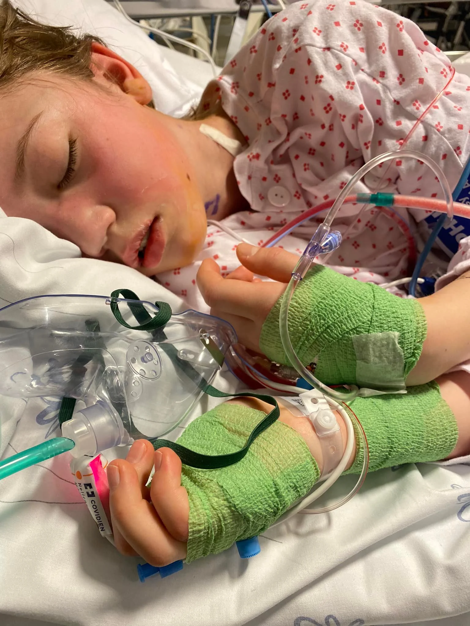 Hi everyone! I&rsquo;m overdue to share some things that our family has been going through. I find it difficult to talk about and you might find it difficult to read. Evla has thyroid cancer. They are 10 years old (almost 11!) and we have been in tre