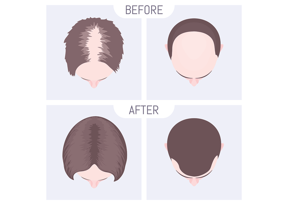 Hair Loss - Causes & Treatments — Doctor Kate Kass