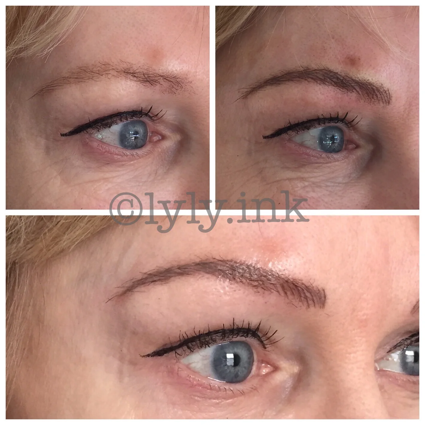 Before, after and healed before touchup