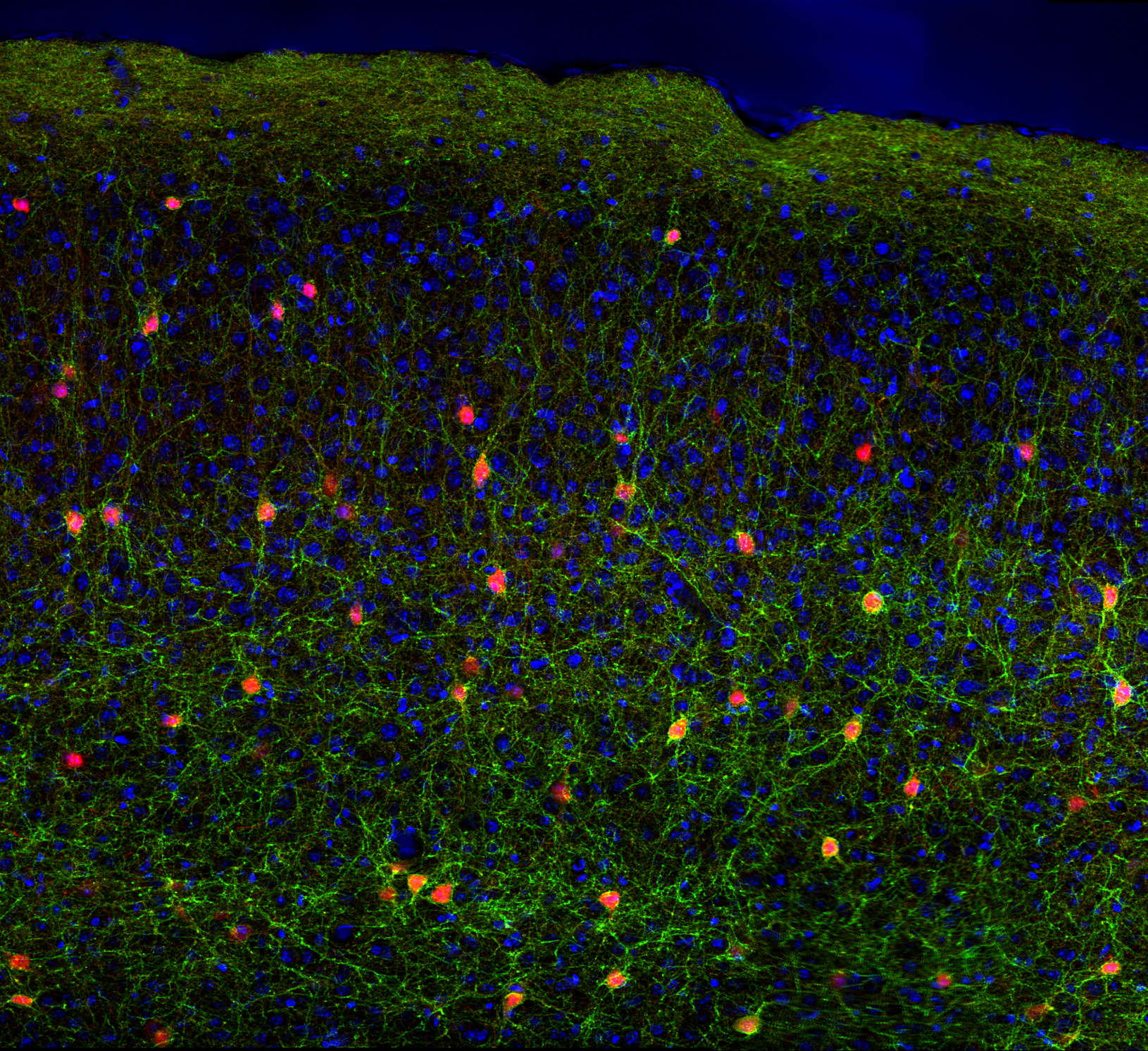 Cortical Somatostatin Neurons