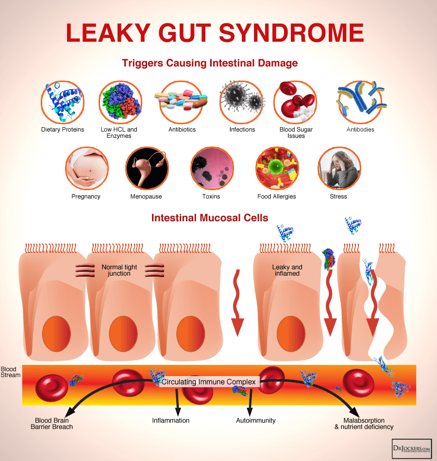 GUTHEALTH_LeakyGutSyndrome.png