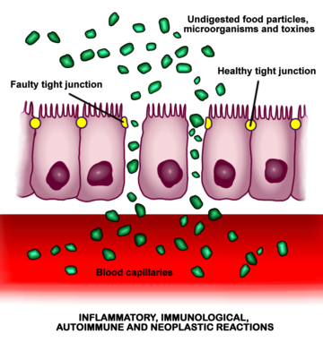 Increased_intestinal_permeability.png