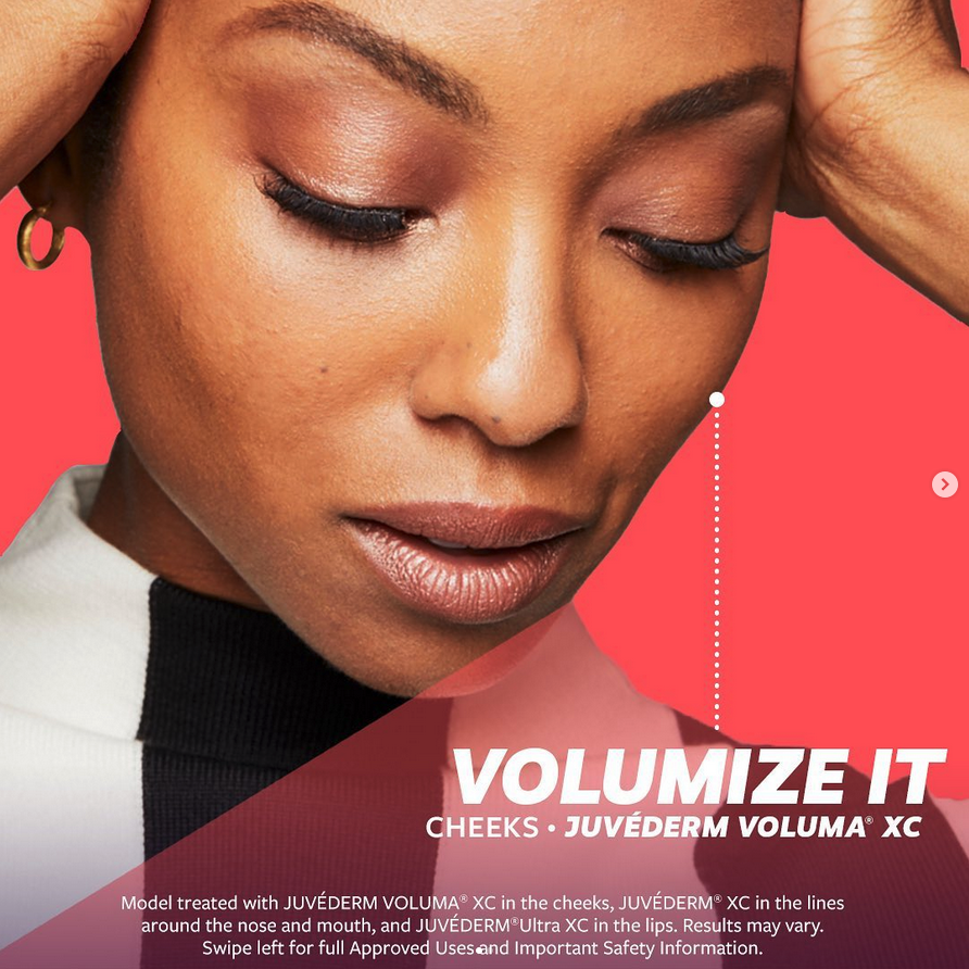 juvederm 3.png