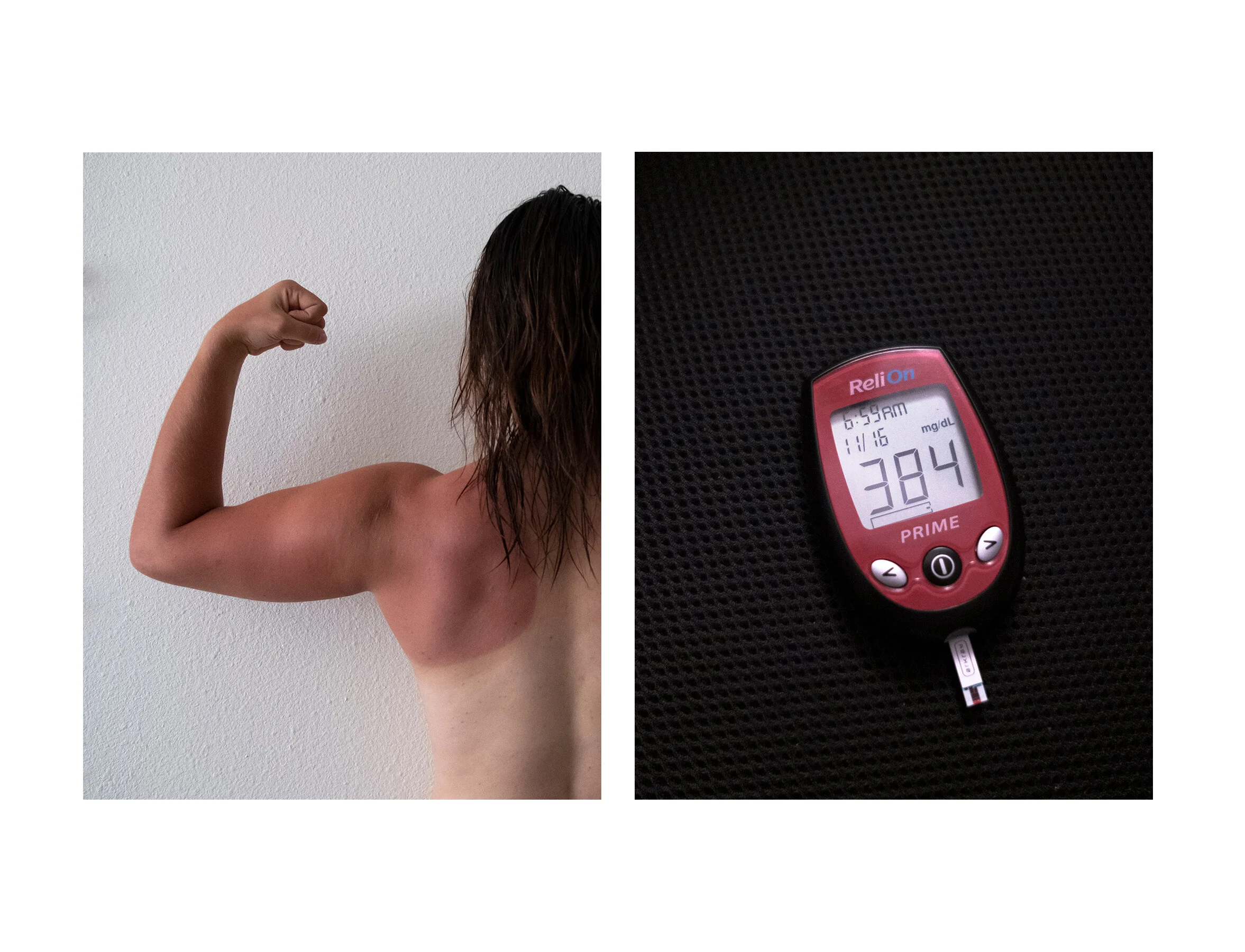  I woke up in the middle of the night with high blood sugar, so I dragged myself out of bed to do 300 squats, 30 pushups and two 2-minute planks, which brought my blood sugar down by 150 units.  