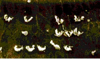 cellules ciliées abimée