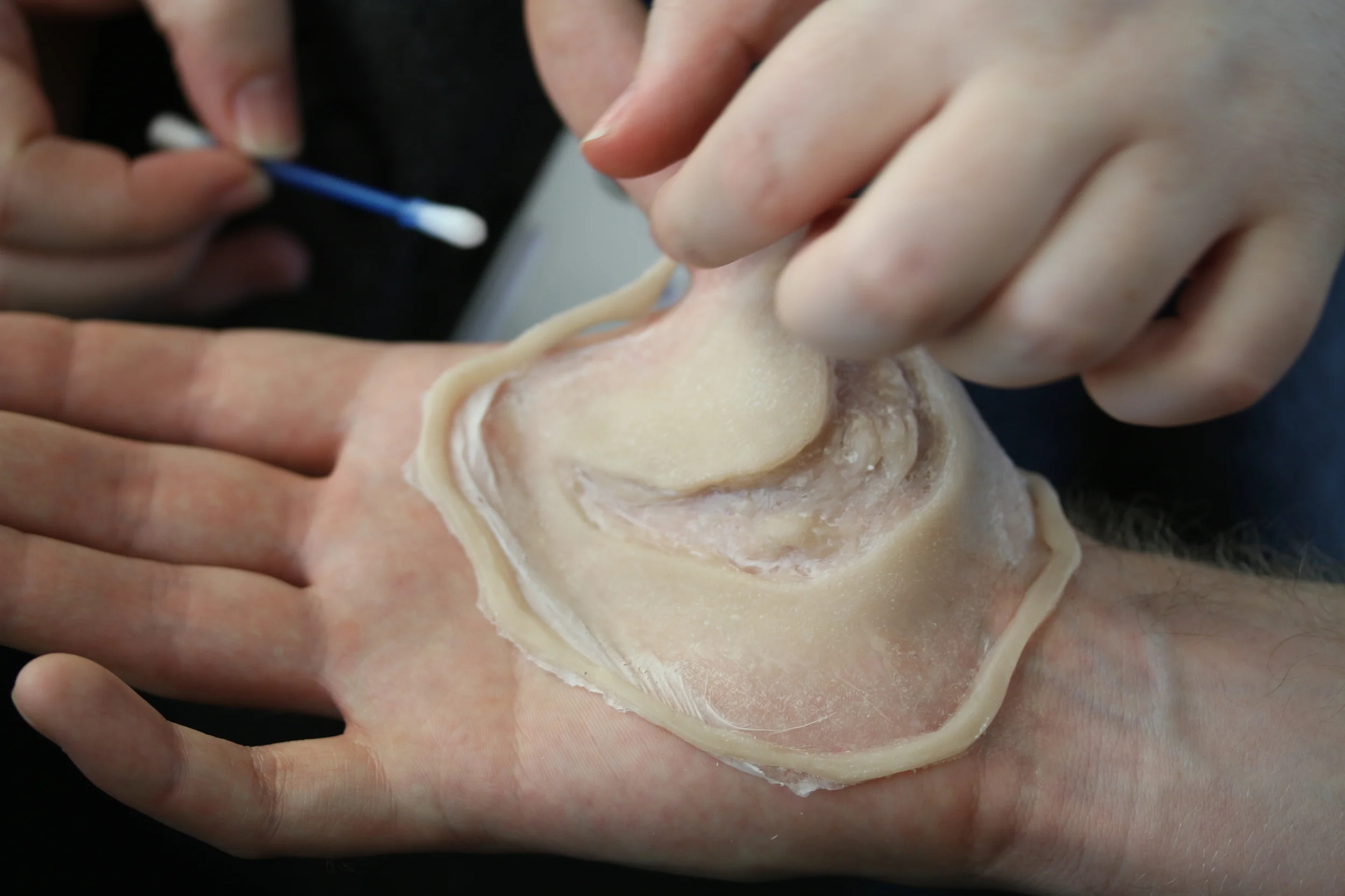 Applying the silicone hand laceration