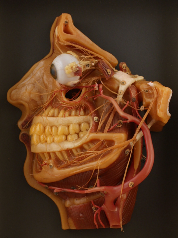 Surg -  Anatomical Wax Model.png