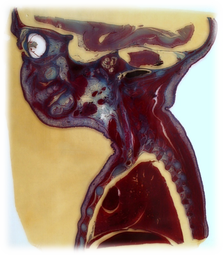 Surg -  Fetal Anatomical Slides.png