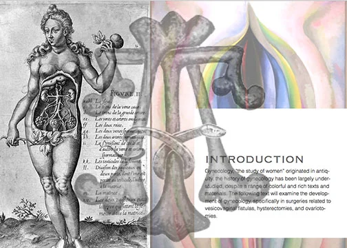 Gyn-intro.jpg