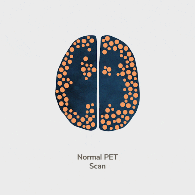 EnlistedWeb_Boulder_BrainAnimation_V2_LR.gif