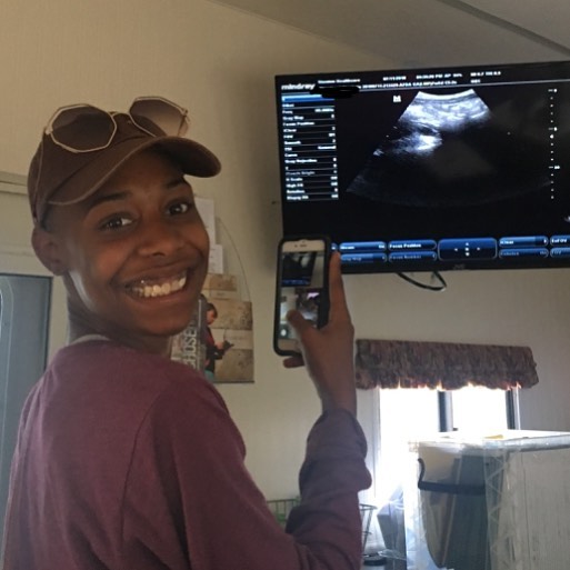 "Best Friend" excitedly captures the first ultrasound moment.