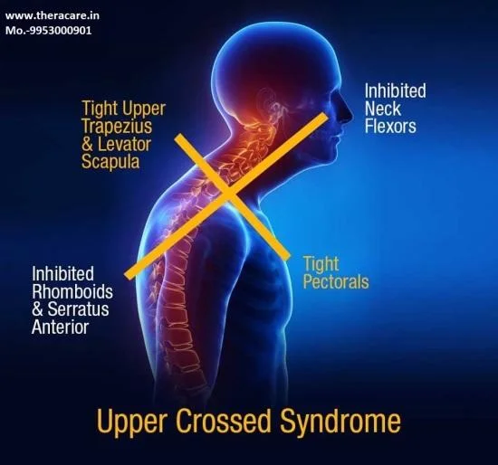 The Push:Pull ratio will help to correct these common postural issues seen in desk-workers