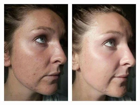 NuGirls Polishing Peel testimonial 3.jpg