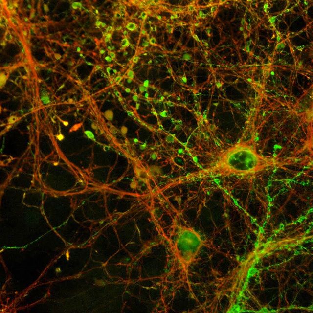 Another beautiful collection of hippocampal neurons infected with an engineered virus that causes neurons to turn fluorescent red, and then green once they fire impulses. We can use a tool like this to identify which neurons are involved in things li