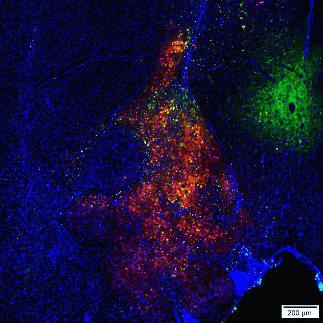 Which neurons become more active when people do cocaine? This virus helps us to see them. At baseline, and without any cocaine, the virus causes neurons to churn out green fluorescent protein &ndash; turning them green. However, once cocaine is admin