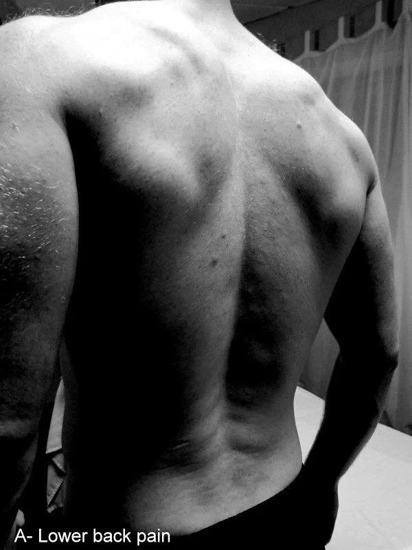 A comprehensive overview of lower back pain — Phila Massages