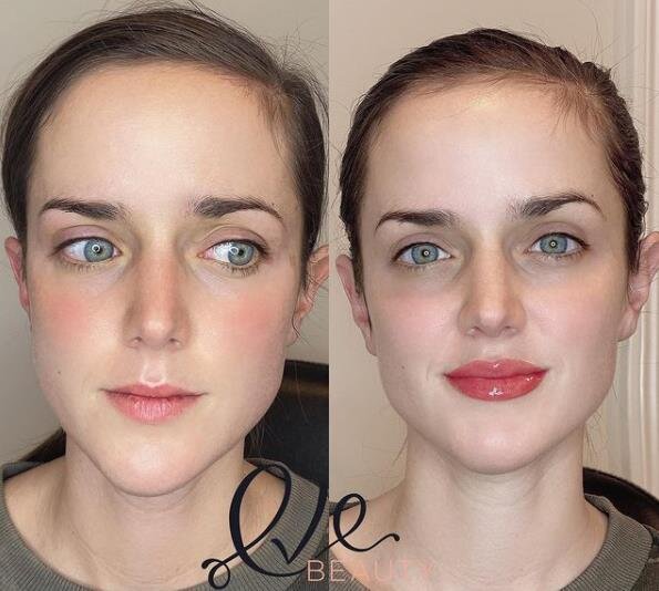 pebermynte Rouse sød smag Permanent Makeup Lip Services in Wakefield, MA — Eve Beauty