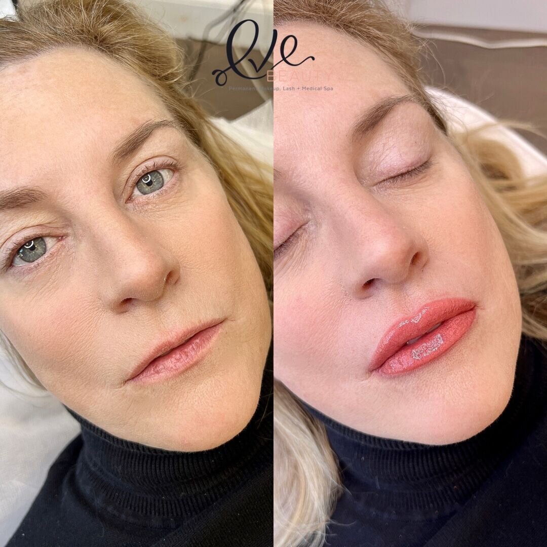 New Year, New Lips! I got my lips blushed a day before Christmas , and this  is how they're looking now! Before, Right after, and the week of healing!  Let me know