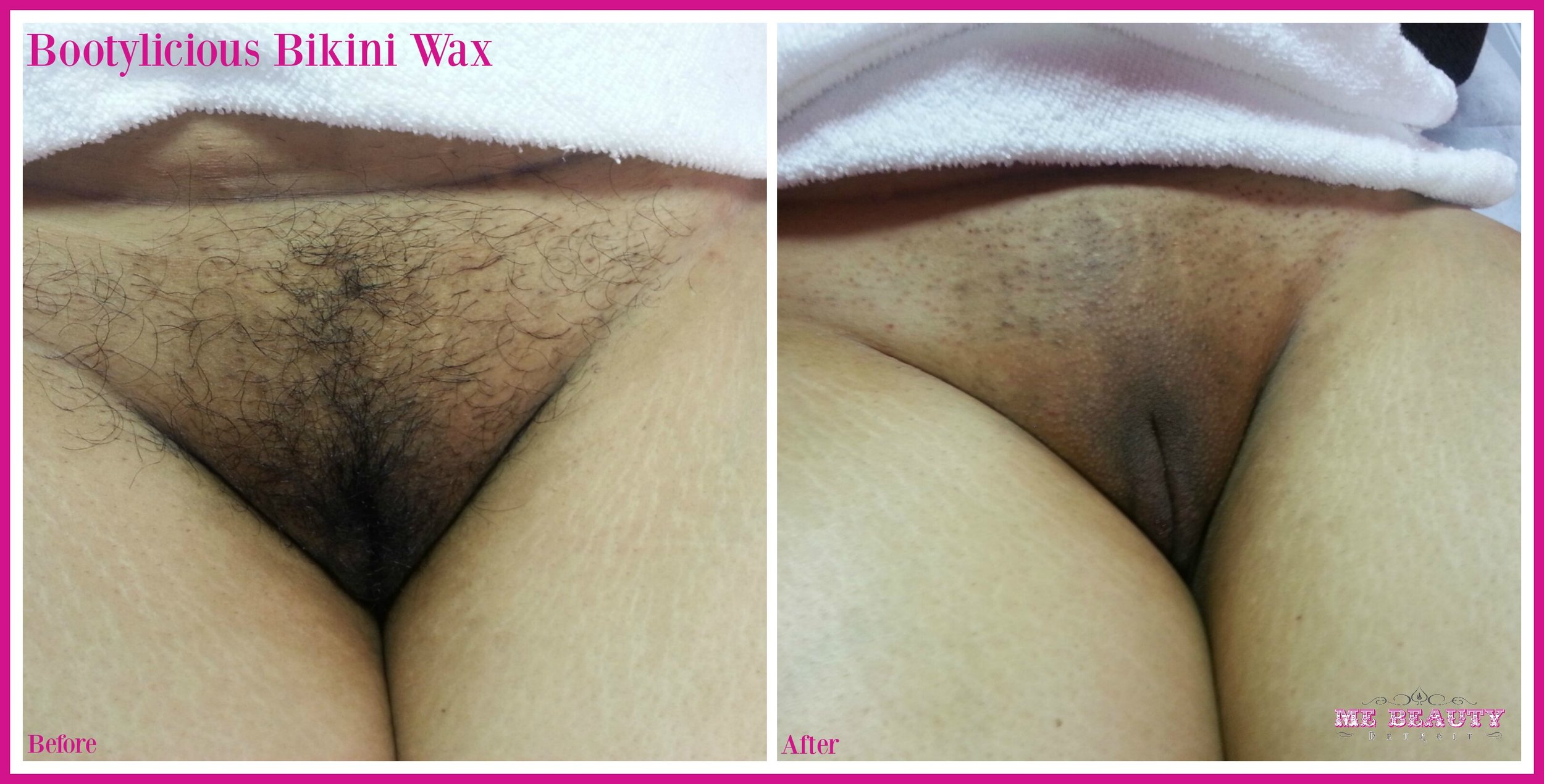 Nude Brazilian Wax Results Photos.
